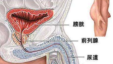 男性支原体(图1)